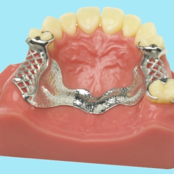 Phục hình tháo lắp hàm khung kim loại