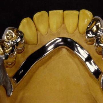 Hàm khung liên kết